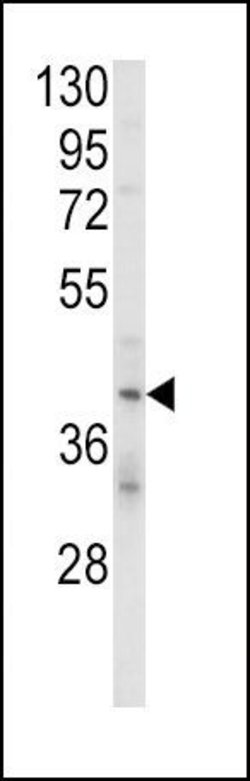 KIR2DL4 Rabbit anti-Human, Polyclonal, Invitrogen 400 &mu;L; Unconjugated:Antibodies,