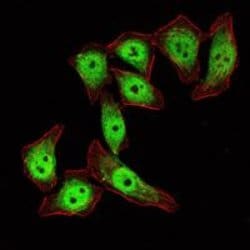 Invitrogen KLF4 Monoclonal Antibody (1E6) 100 &mu;L; Unconjugated:Antibodies,