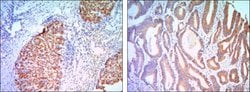 KLHL11 Monoclonal Antibody (1B9C1):Antibodies, Monoclonal