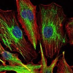 Invitrogen KLHL22 Monoclonal Antibody (7B10) 100 &mu;L; Unconjugated:Antibodies,