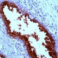 PSA Polyclonal Antibody, Invitrogen 1 mL; Unconjugated:Antibodies, Polyclonal