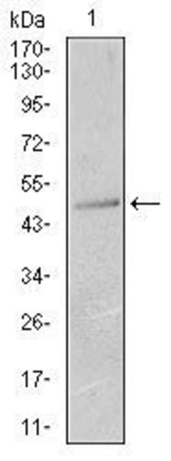 Invitrogen Cytokeratin 13 Monoclonal Antibody (3G4) 100 &mu;g; Unconjugated:Antibodies,