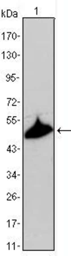 Invitrogen Cytokeratin 15 Monoclonal Antibody (6E7) 100 &mu;L; Unconjugated:Antibodies,