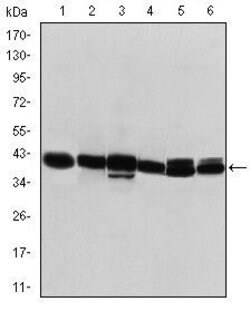 Invitrogen Cytokeratin 19 Monoclonal Antibody (1H6) 100 &mu;L | Buy Online | Invitrogen&trade; | Fisher Scientific