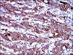 Invitrogen Cytokeratin 19 Monoclonal Antibody (4E8) 100 &mu;L; Unconjugated:Antibodies,