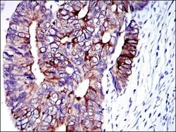Invitrogen Cytokeratin 19 Monoclonal Antibody (4E8) 100 &mu;L; Unconjugated:Antibodies,
