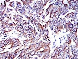 Invitrogen Cytokeratin 19 Monoclonal Antibody (4E8) 100 &mu;L; Unconjugated:Antibodies,