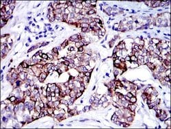 Invitrogen Cytokeratin 19 Monoclonal Antibody (4E8) 100 &mu;L; Unconjugated:Antibodies,