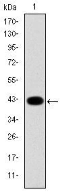 Invitrogen Cytokeratin 19 Monoclonal Antibody (4E8) 100 &mu;L; Unconjugated:Antibodies,