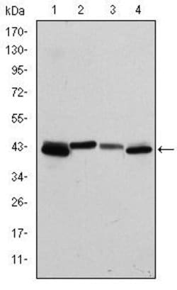 Invitrogen Cytokeratin 19 Monoclonal Antibody (4E8) 100 &mu;L; Unconjugated:Antibodies,