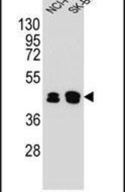 KRT80 Rabbit anti-Human, Polyclonal, Invitrogen 400 &mu;L; Unconjugated:Antibodies,