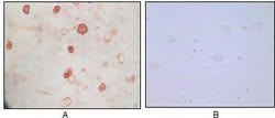 Invitrogen KSHV K8a Monoclonal Antibody (8C12G10G1) 100 &mu;L; Unconjugated:Antibodies,