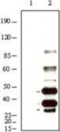 Invitrogen KSHV K8a Monoclonal Antibody (8C12G10G1) 100 &mu;L; Unconjugated:Antibodies,