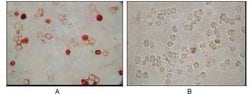 Invitrogen KSHV ORF62 Monoclonal Antibody (5B7B6) 100 &mu;L; Unconjugated:Antibodies,