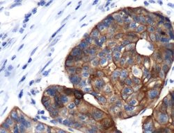 Cytokeratin 17 Rabbit anti-Human, Rat, Polyclonal, Invitrogen 500 &mu;L;