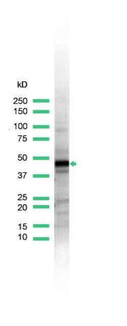 Cytokeratin 17 Rabbit anti-Human, Rat, Polyclonal, Invitrogen 500 &mu;L;