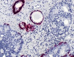 Invitrogen Cytokeratin 5 Monoclonal Antibody (SP27) 500 &mu;L; Unconjugated:Antibodies,