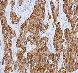 Invitrogen Cytokeratin 8 Monoclonal Antibody (SP102) 500 &mu;L; Unconjugated:Antibodies,