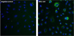 Invitrogen LAMP1 Monoclonal Antibody (LY1C6) 100 &mu;g; Unconjugated:Antibodies,