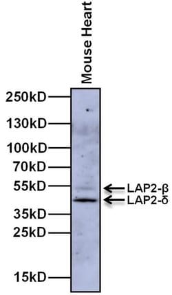 Invitrogen LAP2 Monoclonal Antibody (RL29) 100 &mu;g; Unconjugated:Antibodies,
