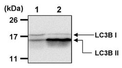 Invitrogen LC3B Polyclonal Antibody, DyLight 650 100 &mu;L; DyLight 650:Antibodies,