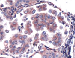 LIMD1 Rabbit anti-Human, Polyclonal, Invitrogen 500 μL; Unconjugated:Antibodies,