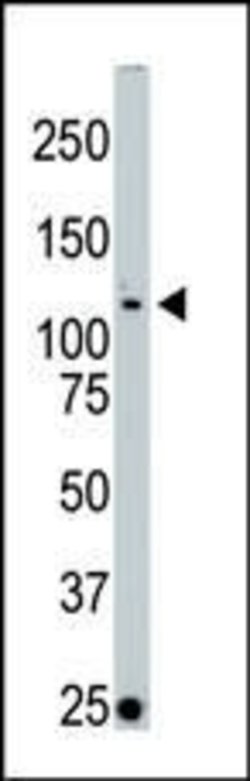 LOK Rabbit anti-Human, Polyclonal, Invitrogen 400 &mu;L; Unconjugated:Antibodies,