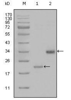 Invitrogen LPA Monoclonal Antibody (8F6A9,8H5C5) 100 &mu;L; Unconjugated:Antibodies,
