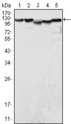 Invitrogen LSD1 Monoclonal Antibody (1B2E5) 100 &mu;L | Buy Online | Invitrogen&trade; | Fisher Scientific