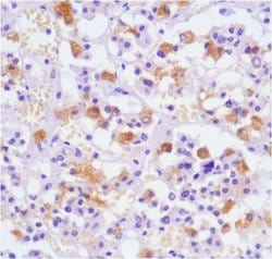Invitrogen Luteinizing Hormone Monoclonal Antibody (SP132) 500 &mu;L; Unconjugated:Antibodies,