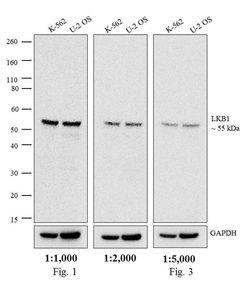 Invitrogen Goat anti-Mouse IgG2a Secondary Antibody, HRP 1 mL; HRP:Antibodies,