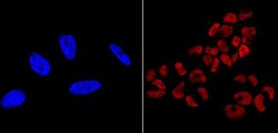 Invitrogen SOX2 Monoclonal Antibody (20G5), DyLight 550 100 &mu;L; DyLight