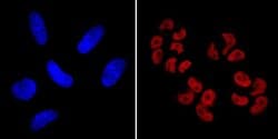 Invitrogen SOX2 Monoclonal Antibody (20G5), DyLight 650 100 &mu;L; DyLight