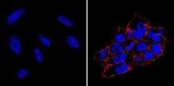 Invitrogen SSEA4 Monoclonal Antibody (MC-813-70), DyLight 550 100 &mu;L;