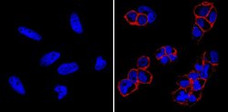 SSEA4 Monoclonal Antibody (MC-813-70), DyLight 650, Invitrogen 100 &mu;L;