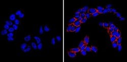 Invitrogen™ SSEA1 Monoclonal Antibody (MC-480), DyLight™ 650