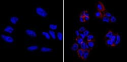 Invitrogen™ TRA-1-60 Monoclonal Antibody (TRA-1-60), DyLight™ 550