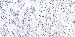 Invitrogen GATA3 Monoclonal Antibody (1A12-1D9) 100 &mu;g; Unconjugated:Antibodies,