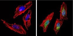 Invitrogen AKT2 Monoclonal Antibody (4H7) 20 &mu;L; Unconjugated:Antibodies,