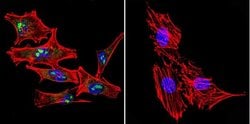STAT1 Monoclonal Antibody (15H3):Antibodies, Monoclonal