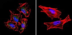 STAT1 Monoclonal Antibody (15H3):Antibodies, Monoclonal