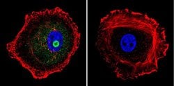 STAT1 Monoclonal Antibody (15H3):Antibodies, Monoclonal