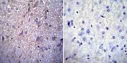 Invitrogen NUP62 Monoclonal Antibody (RL1) 100 &mu;L; Unconjugated:Antibodies,