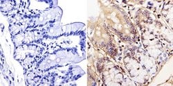 Invitrogen LAP1 Monoclonal Antibody (RL13) 200 &mu;L; Unconjugated:Antibodies,