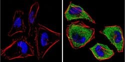 Invitrogen MEK1 Monoclonal Antibody (1C1) 100 &mu;g; Unconjugated:Antibodies,
