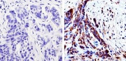 Invitrogen MEK1 Monoclonal Antibody (1C1) 100 &mu;g; Unconjugated:Antibodies,