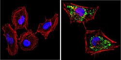 Invitrogen SOD2 Monoclonal Antibody (1H6) 100 &mu;g; Unconjugated:Antibodies,