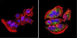 Invitrogen Nestin Monoclonal Antibody (10C2) 100 &mu;g; Unconjugated:Antibodies,
