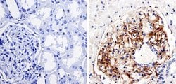 Invitrogen Nestin Monoclonal Antibody (10C2) 100 &mu;g; Unconjugated:Antibodies,