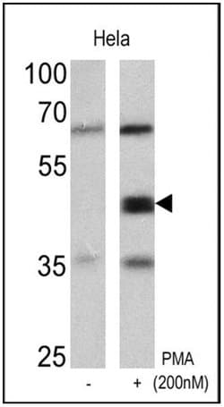 Invitrogen Phospho-CREB/ATF1 (Ser133, Ser63) Monoclonal Antibody (10E9)